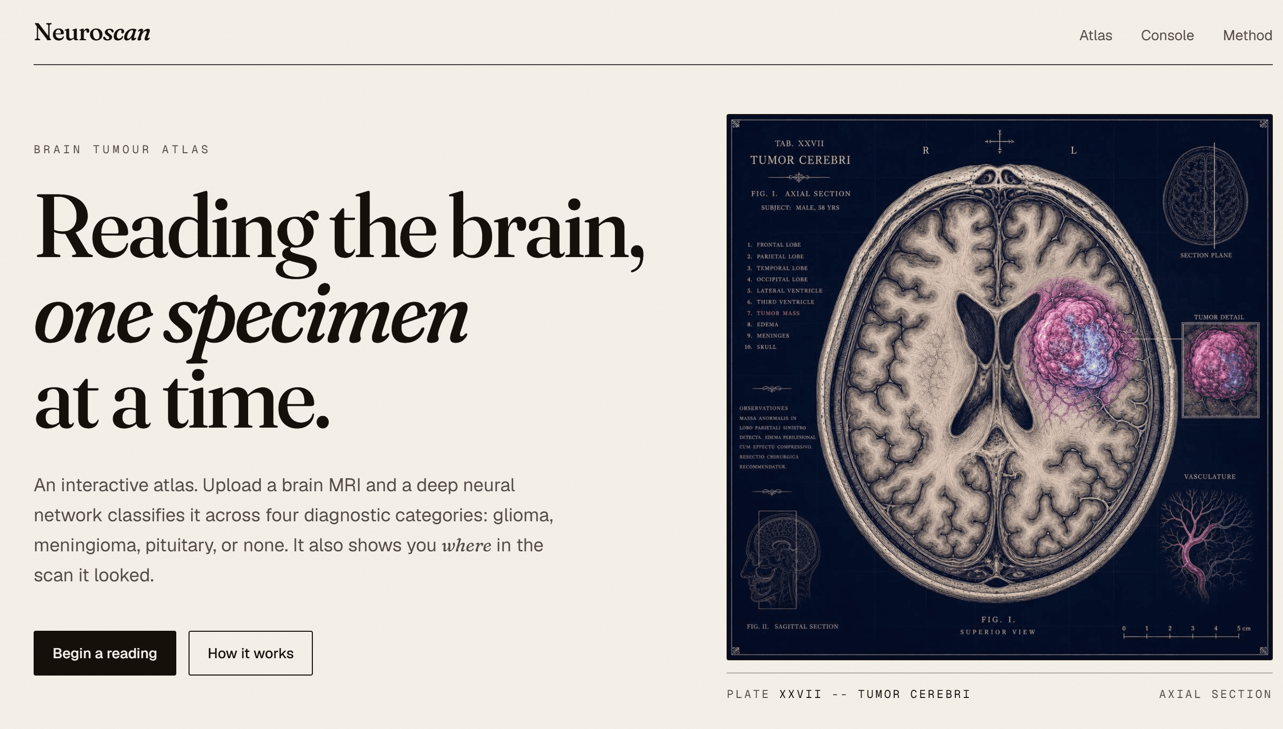 NeuroScan project screenshot